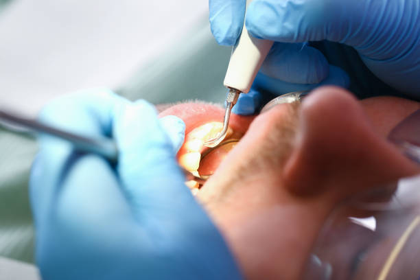 Best Emergency Dentist for Knocked-Out Tooth in Jefferson, IA